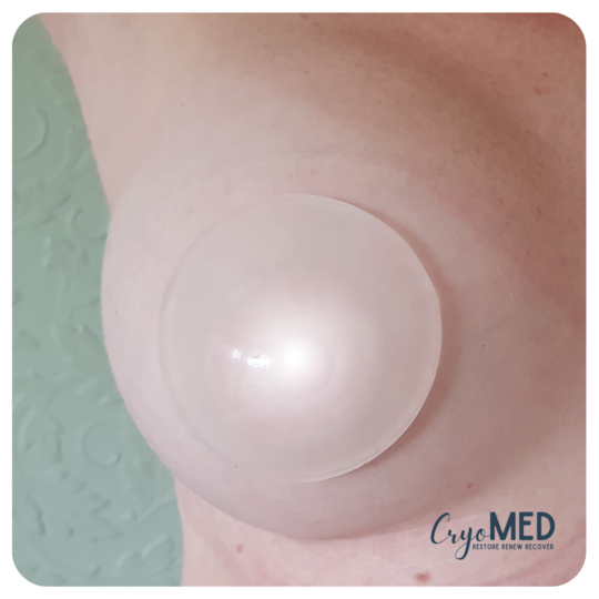 CryoMed Eyes and breast - 1 pair (10 uses)
