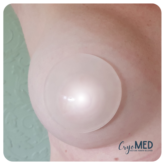 cryoSlice Eyes and breast - 1 pair (5 uses)