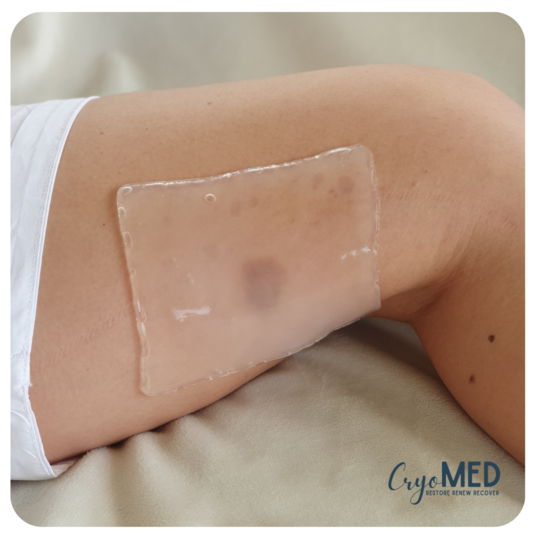 CryoMed Square- 1 piece (re-useable x10)
