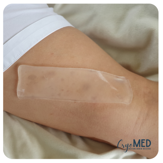 CryoMed Double Rectangle (Scars/Cuts)
