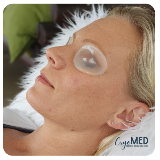 CryoMed 2x Ovals (Eyes only) 10 Uses