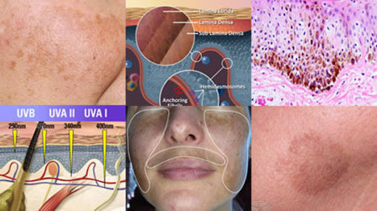 Essentials of Pigmentation and the Melanogenesis Process