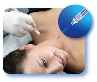 Oxy Jet Peel Rental