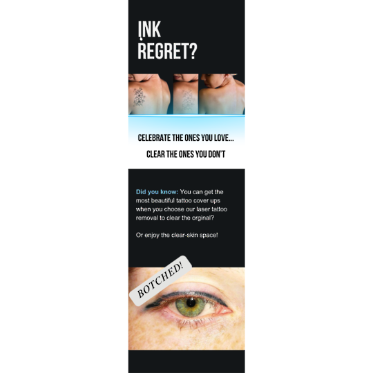 Tattoo Removal Poster A3