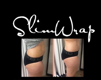 Slimwrap-before-after-340